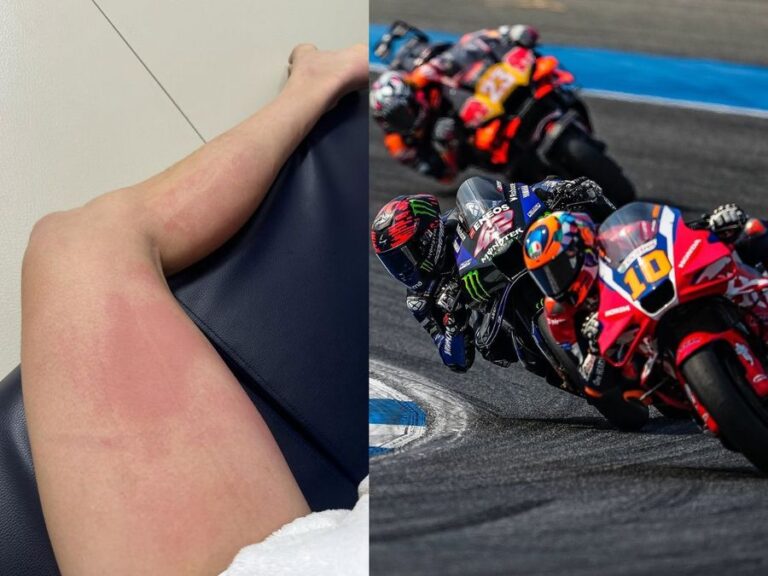 Joan Mir & Alex Rins undergo burns from overheating at Thailand Grand Prix