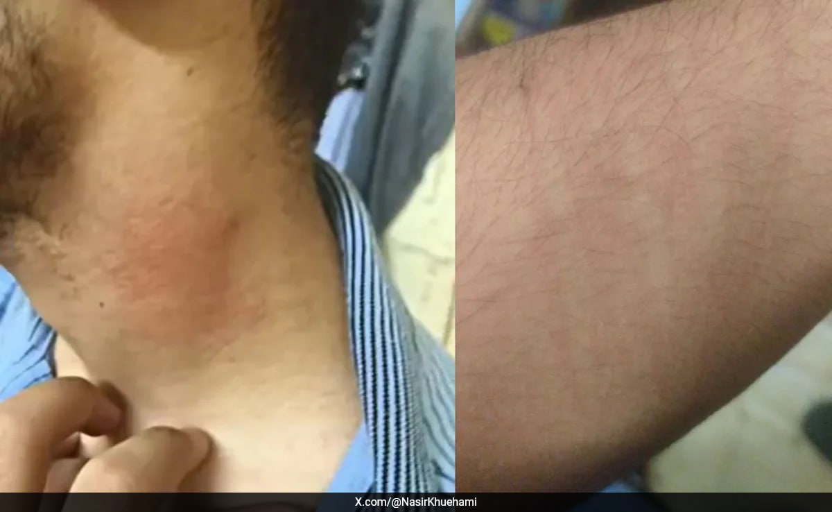 J&K Student Thrashed In Nagpur